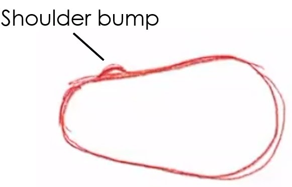 A pear-shaped oval with a "shoulder bump" label on top